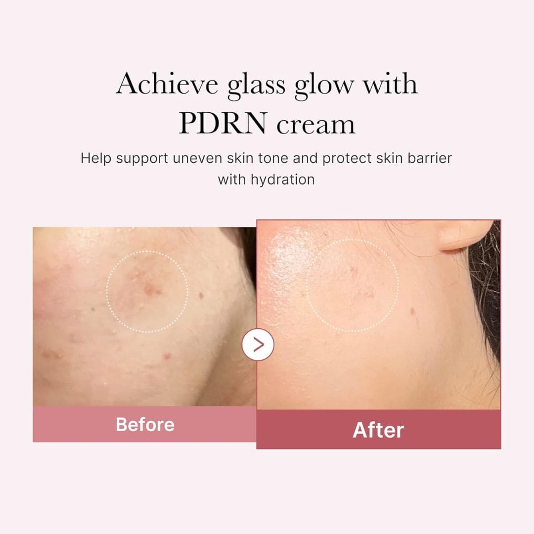 Medicube PDRN Pink Hyaluronic Moisturizing Cream – 3 Pack | 3 × 50 mL