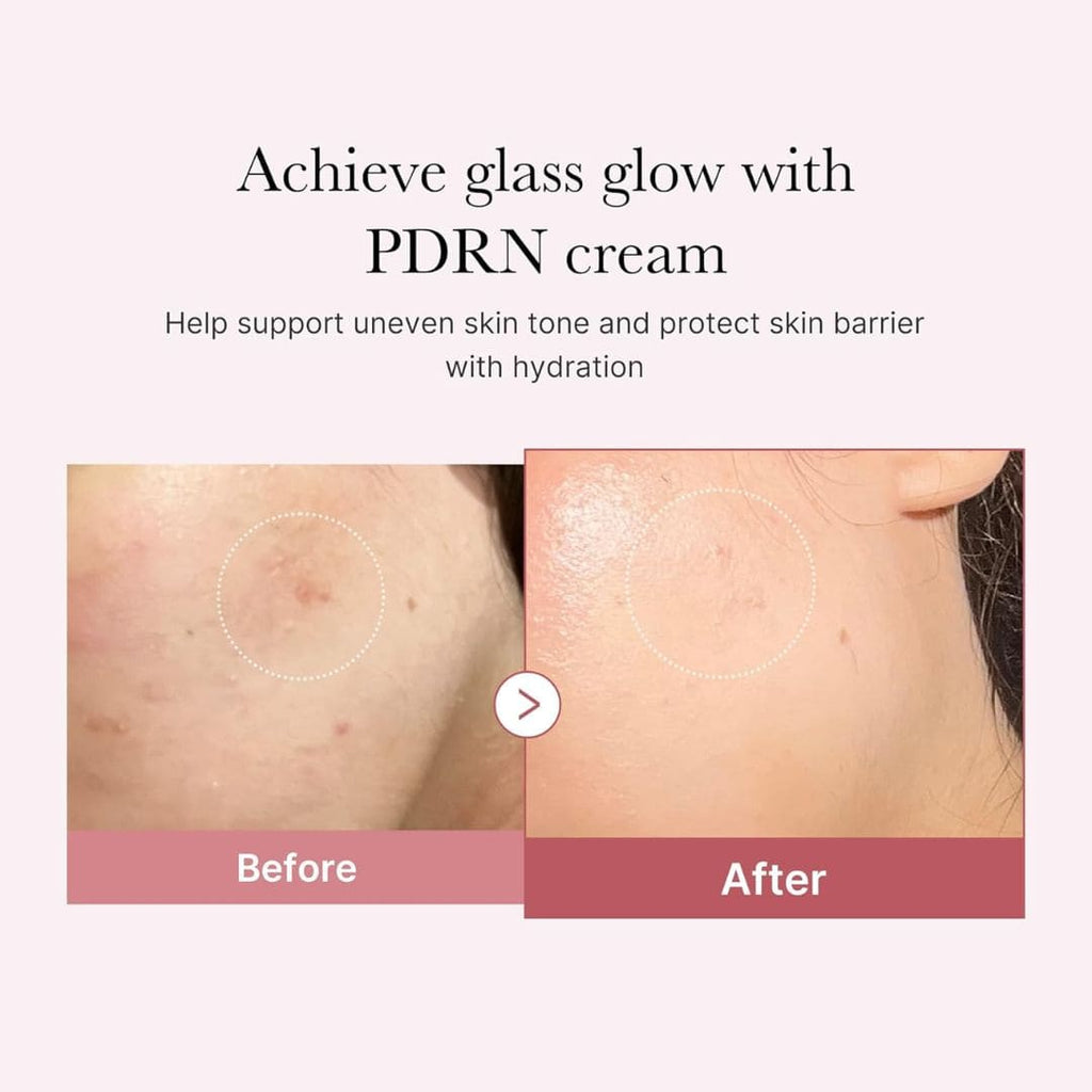 Medicube PDRN Pink Hyaluronic Moisturizing Cream – 50ml