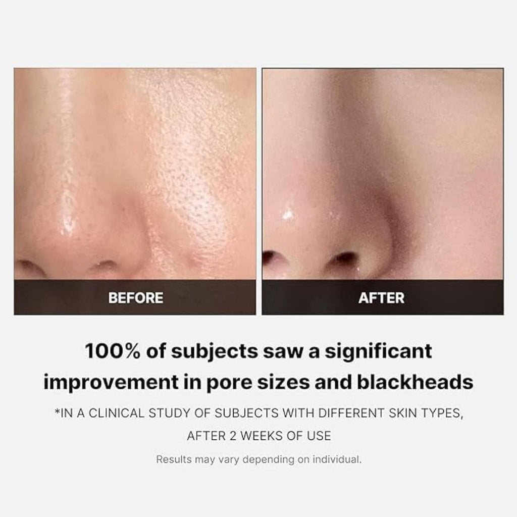 Medicube Zero Pore Pad 2.0 – 70 Pads